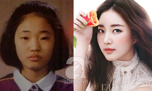 12 mỹ nhân Hàn thành công nhờ dao kéo - 11