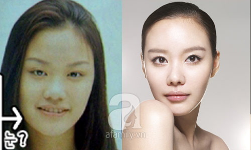 12 mỹ nhân Hàn thành công nhờ dao kéo - 12