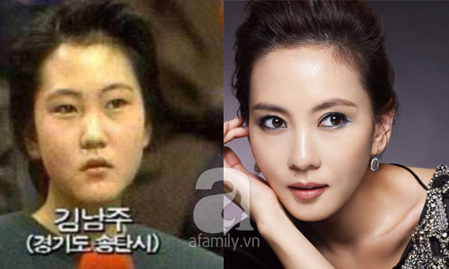 12 mỹ nhân Hàn thành công nhờ dao kéo - 2