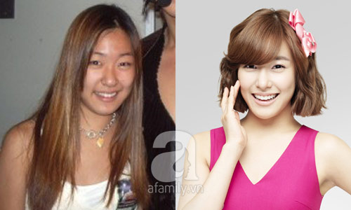 12 mỹ nhân Hàn thành công nhờ dao kéo - 3