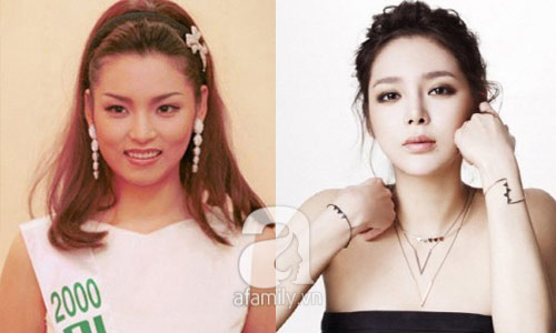 12 mỹ nhân Hàn thành công nhờ dao kéo - 4