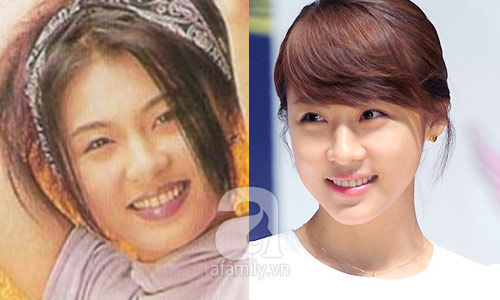 12 mỹ nhân Hàn thành công nhờ dao kéo - 5