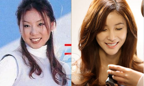 12 mỹ nhân Hàn thành công nhờ dao kéo - 6