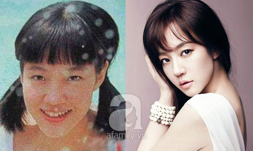 12 mỹ nhân Hàn thành công nhờ dao kéo - 7