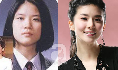 12 mỹ nhân Hàn thành công nhờ dao kéo - 8