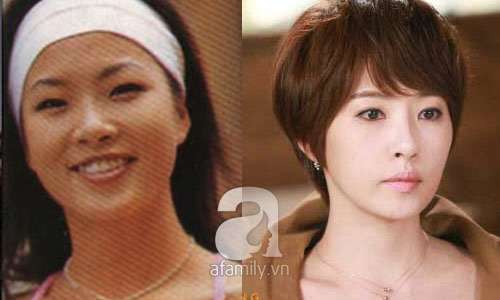 12 mỹ nhân Hàn thành công nhờ dao kéo - 9