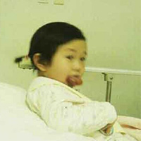 Phi thường - kỳ quặc - Xót xa bé 3 tuổi có lưỡi khổng lồ