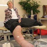 Tin tức trong ngày - Người phụ nữ có chân to nhất thế giới