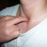 Sức khỏe đời sống - Tự xoa bóp phòng chống hen phế quản