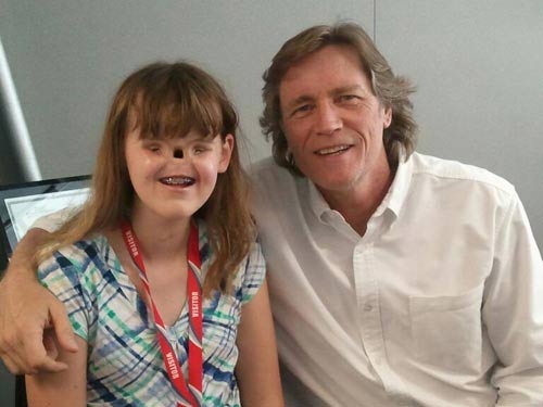 Thương tâm bé gái không mắt không mũi - 2