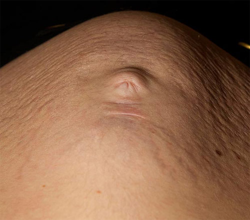 Nhìn thấy mặt con qua bụng bầu - 2