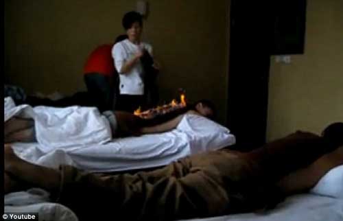 TQ: Kỳ lạ làm đẹp bằng cách đốt lửa trên da - 2