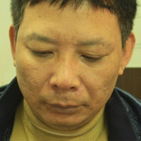 Pháp luật - Bắt trùm ma túy với hàng nghìn viên thuốc lắc