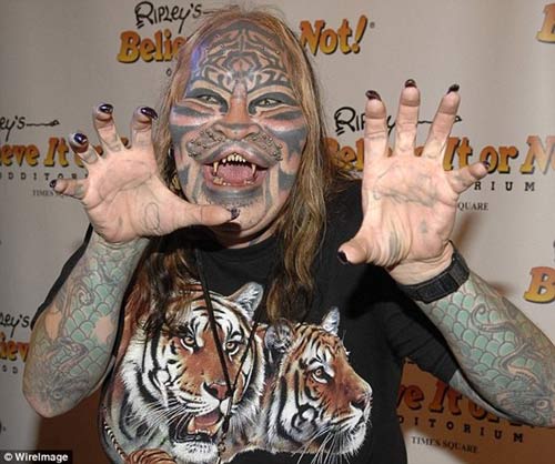 3 ca phẫu thuật thẩm mỹ oái oăm nhất thế giới - 4