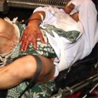 Phi thường - kỳ quặc - Hoảng sợ nạn ăn cắp "của quý"