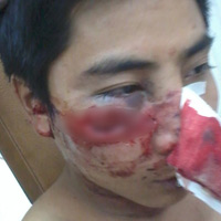 Pháp luật - 141 HN bị “tố” đánh gẫy xương gò má người dân