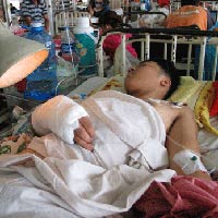 Pháp luật - Côn đồ dùng mã tấu chém lìa bàn tay học sinh