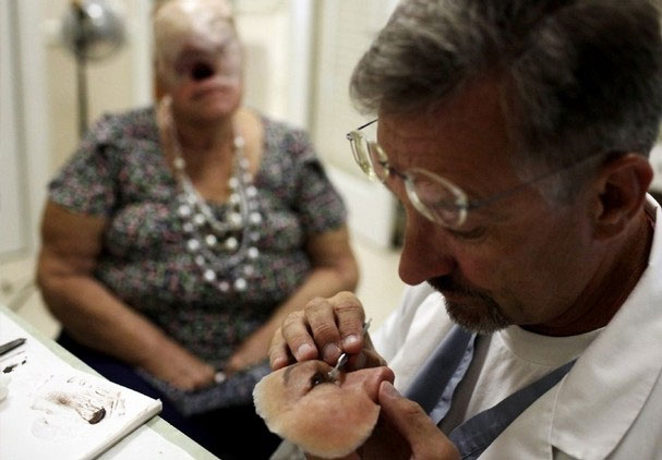 Cận cảnh tái tạo khuôn mặt biến dạng - 4