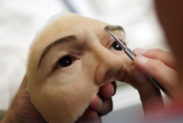 Cận cảnh tái tạo khuôn mặt biến dạng - 5