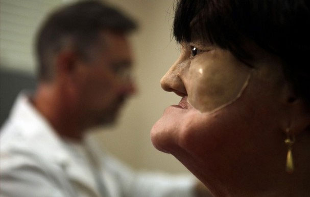 Cận cảnh tái tạo khuôn mặt biến dạng - 10