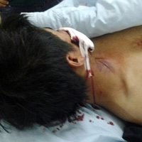 Tin tức trong ngày - CA Hà Nội kết luận vụ 141 bị "tố" đánh người