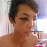 Pháp luật - Tiếp vụ CA xã bị tố nổ súng, đánh người