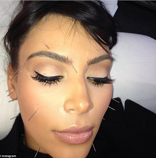 Kim Kardashian khoe mặt đầy kim châm - 1