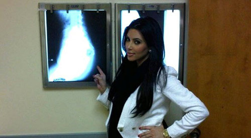 Sao tinh quái chứng minh mũi thật - 7