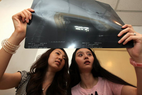 Sao tinh quái chứng minh mũi thật - 4