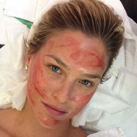 Làm đẹp - Giật mình với mặt "ma cà rồng" của siêu mẫu