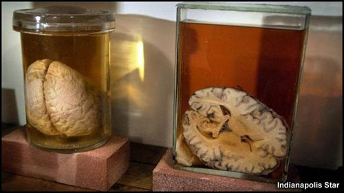 Mỹ: Bắt kẻ rao bán 60 bộ não người trên eBay - 2