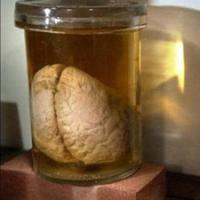 Tin tức trong ngày - Mỹ: Bắt kẻ rao bán 60 bộ não người trên eBay