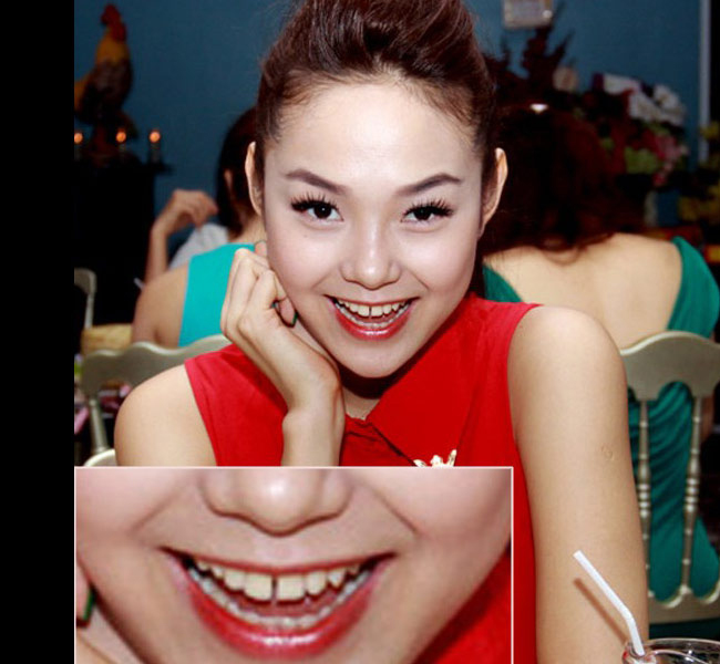 Minh Hằng có gương mặt xinh xắn nhưng hàm răng của cô khá thưa.
