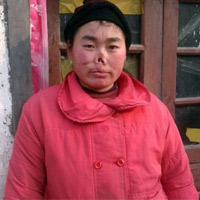 Phi thường - kỳ quặc - Cô gái bị chuột cắn đứt... mũi