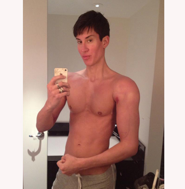 Anh Justin đã thực hiện bơm ngực, tiêm silicon tạo bụng sáu múi, cơ bắp tay và cơ bắp đùi.
