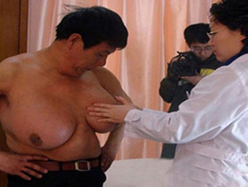 3 chàng trai ngực "to hơn phụ nữ" - 3