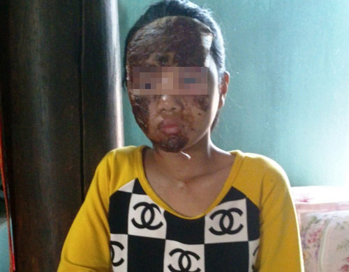 Vụ nổ đài cassette: Chồng con nằm trên vũng máu - 2