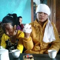 Tin tức trong ngày - Vụ nổ đài cassette: Chồng con nằm trên vũng máu