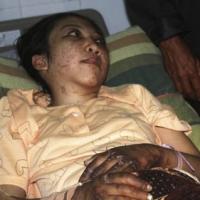 Tin tức trong ngày - Hong Kong: Osin bị chủ hành hạ như thời Trung cổ