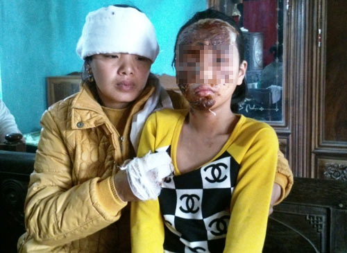 Vẽ chân dung nghi phạm gây ra vụ nổ đài cassette - 2