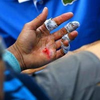 Thể thao - Nadal có thể bại trận vì tay đau