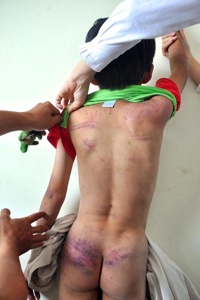Những vụ bạo hành trẻ em gây chấn động - 3