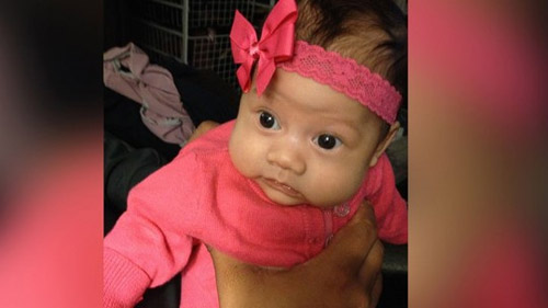 Bé gái sinh ra không có máu - 2