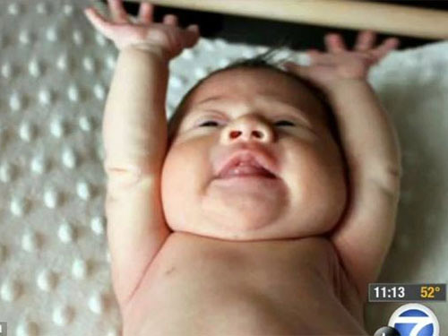 Bé gái sinh ra không có máu - 1