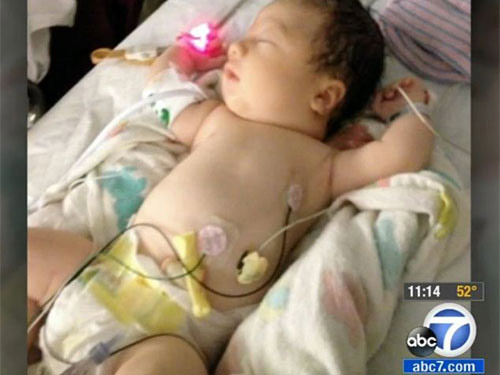 Bé gái sinh ra không có máu - 3