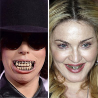 Những hàm răng kỳ quái của sao Hollywood