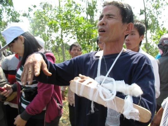 Khán giả, kỵ sĩ bị thương tại hội đua ngựa - 7