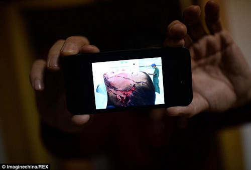 TQ: Cô cắt rời tai cháu bằng dao gọt hoa quả - 3