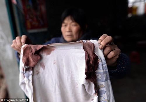 TQ: Cô cắt rời tai cháu bằng dao gọt hoa quả - 2