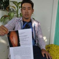 Pháp luật - Điều tra vụ công an xã “vô cớ” bắn dân